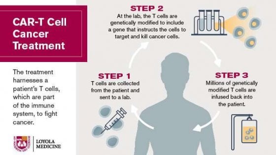 Cura del cancro : car-t la terapia genica contro i tumori apre nuove prospettive e forse una nuova era per la lotta ai tumori